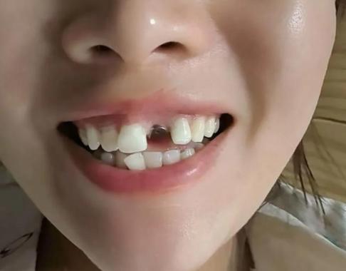 长沙看牙能网上问医生吗?口腔在线解答到底靠不靠谱