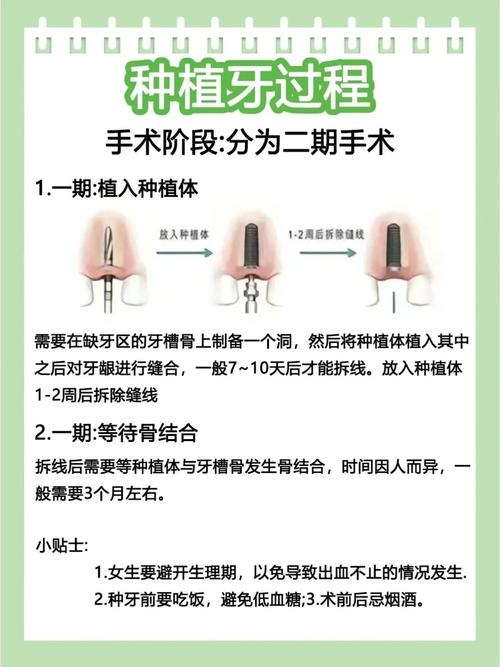 长沙种牙不是埋种子等发芽 手术过程疼不疼要多久