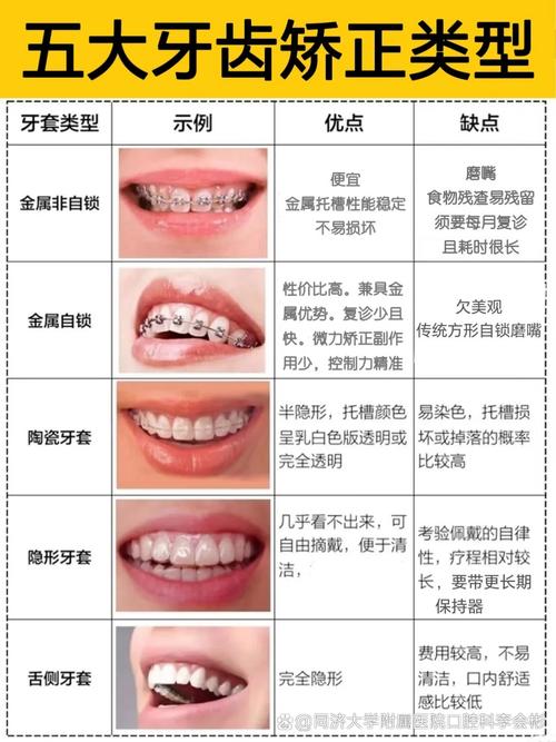 长沙21岁矫正牙齿不晚！成人正畸时长与效果解析