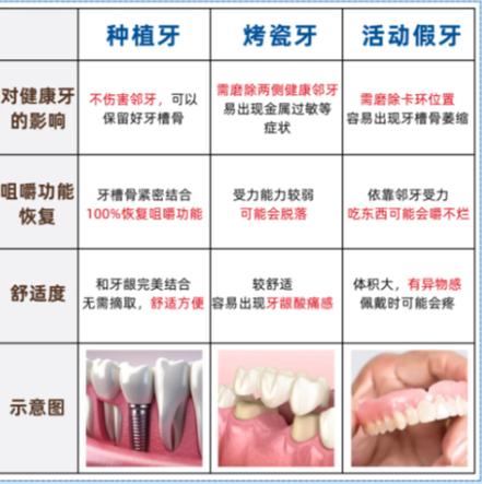 长沙赤峰种牙别乱选 公立三甲医院才靠谱