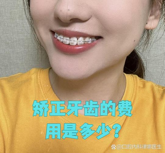 长沙纠正牙型费用全解析：矫正牙齿一般要多少钱