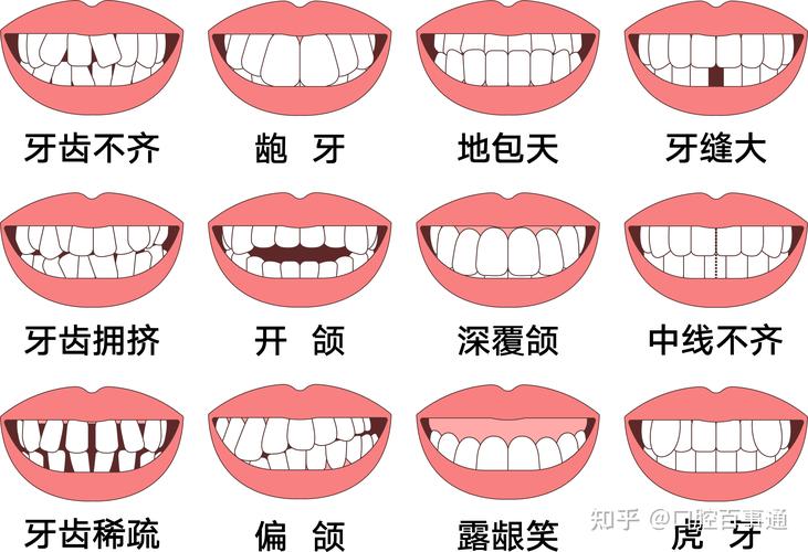 长沙25岁矫正牙齿还来得及吗真实经历分享