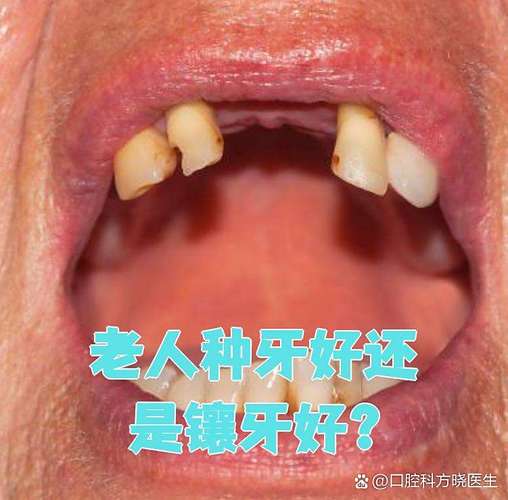 长沙74岁老人种牙晚不晚？医生揭秘高龄种植的真实风险与收益