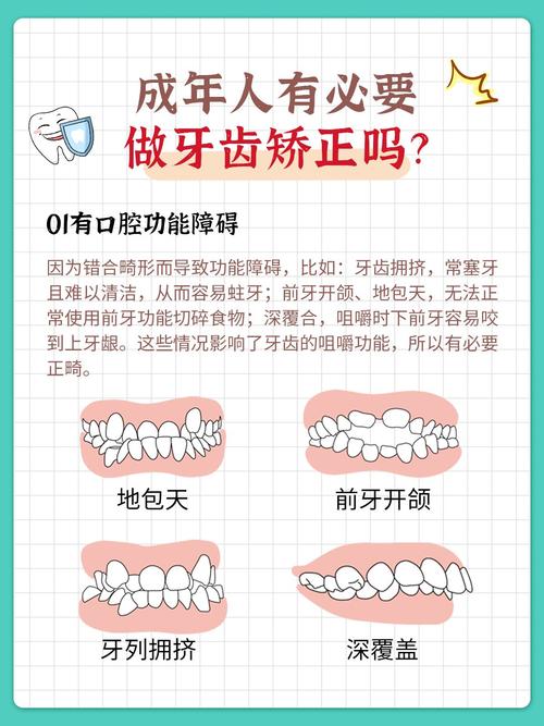 长沙20岁做牙齿矫正一点都不晚！成人矫正需要多久？