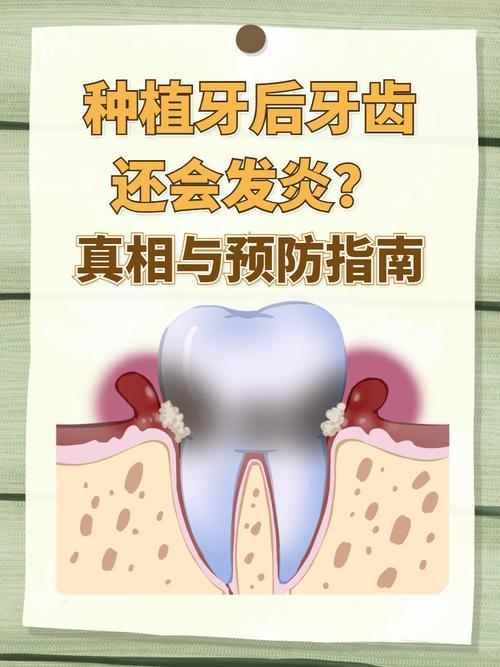 长沙种植牙严重松动发炎，什么情况需要拔除？