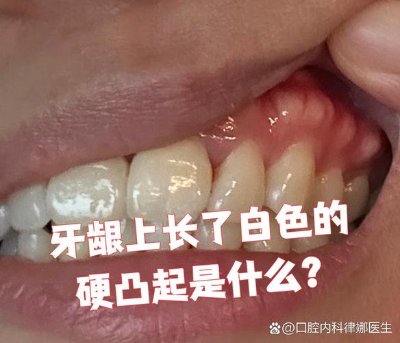 长沙缺一颗牙一定要种吗 不种的后果你承受得起吗