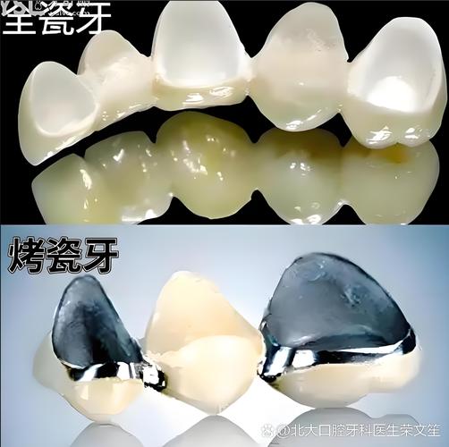 长沙现在种一颗牙到底要花多少钱