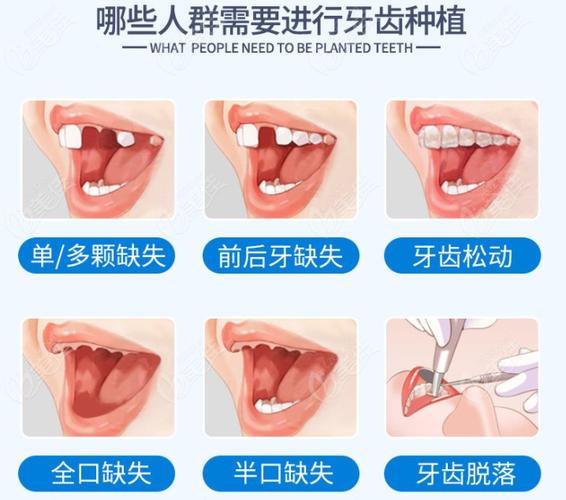 长沙保定口腔医院收费多少钱？看牙项目全解析