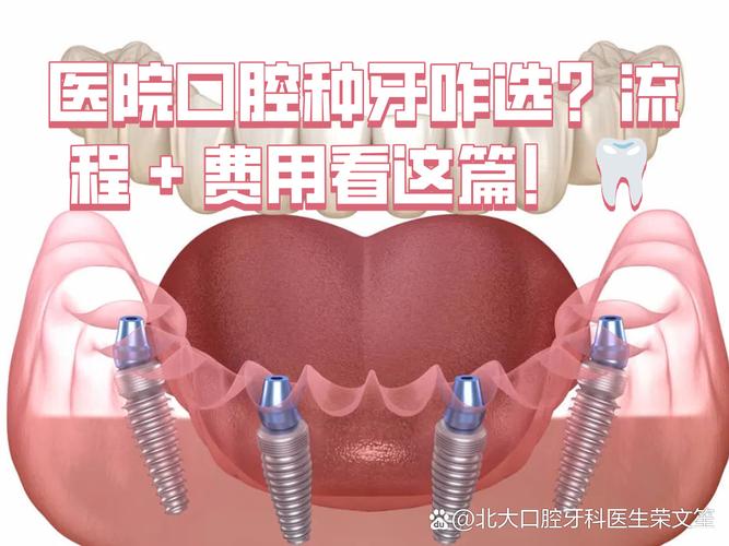 长沙深圳连锁牙科种牙贵不贵？值不值得选？