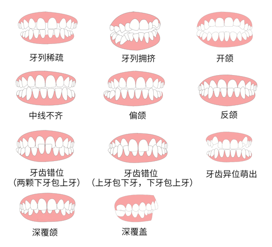 长沙30岁做牙齿矫正到底值不值 利与弊全分析