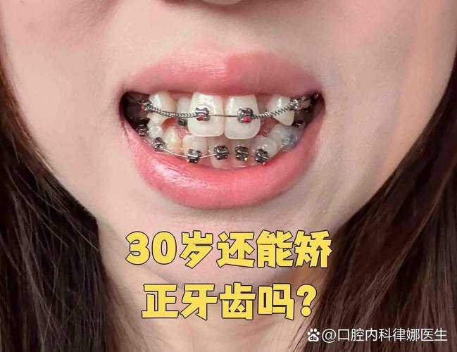 长沙30岁龅牙可以矫正回来吗