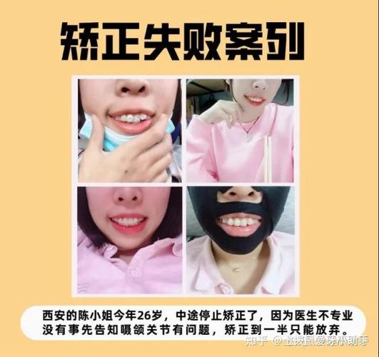 长沙临沧牙齿矫正医院排名：这三家才是真靠谱