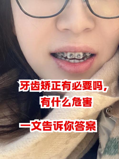 长沙13岁牙齿矫正有后遗症吗？会松动、牙套脸？家长必看
