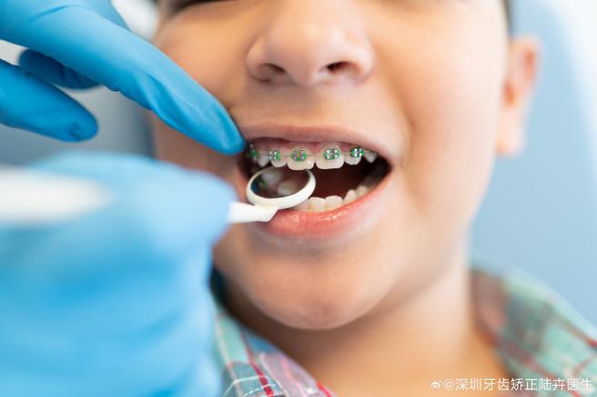 长沙8岁孩子门牙龅牙矫正方法 儿童早期干预怎么做
