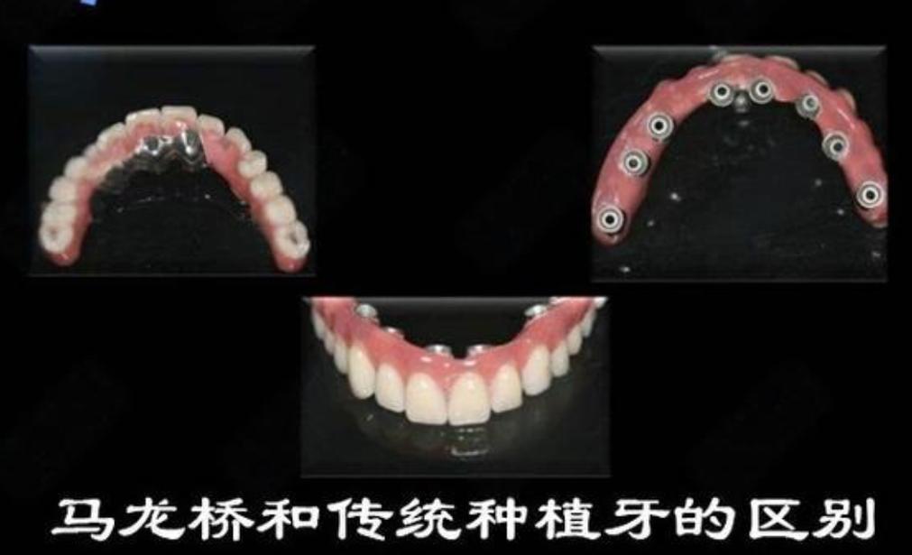 长沙大同种牙哪里好 选公立还是私立更靠谱
