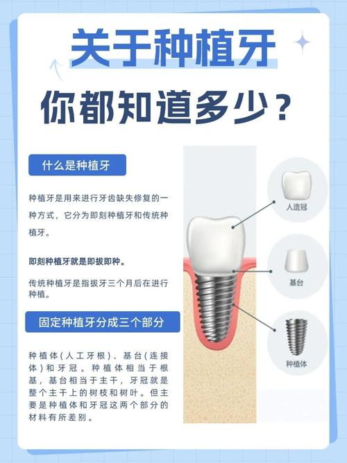 长沙4颗牙一起种到底靠不靠谱 种植医生一次性讲清楚