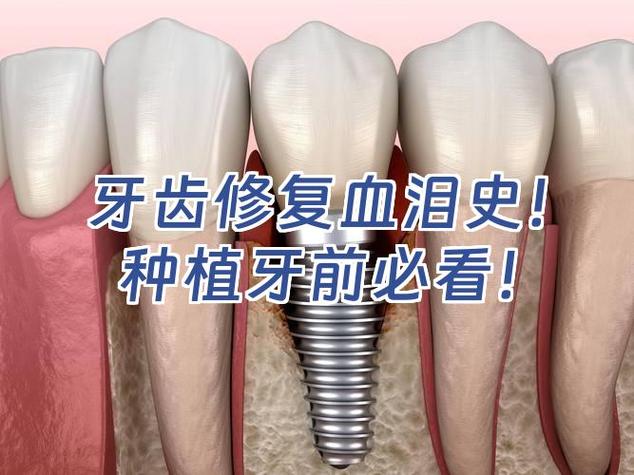长沙种植牙失败了怎么办 修复费用要多少才合理