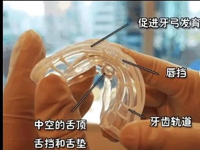 长沙深圳南山儿童隐形MRC矫正费用到底多少钱？