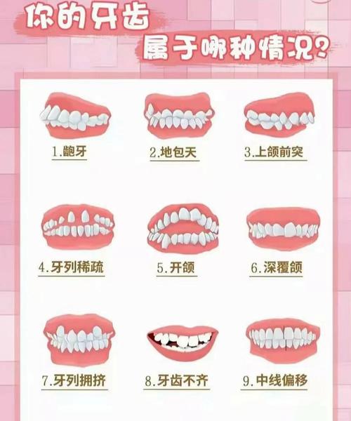 长沙孩子几岁矫正牙齿最好 成人还能矫正吗