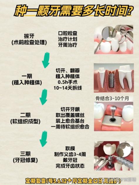 长沙种牙前做CT是必须的吗 2026种牙CT检查费用全解析