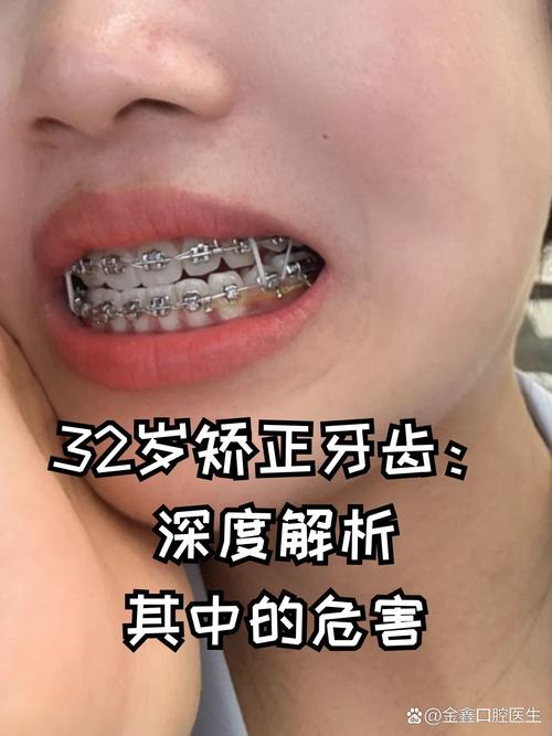 长沙26岁牙齿矫正还来得及吗 成人正畸的真相与建议