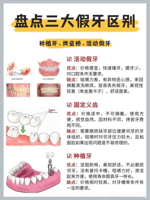 长沙牙齿掉了是种牙还是镶牙 种牙过程和价格一文说清