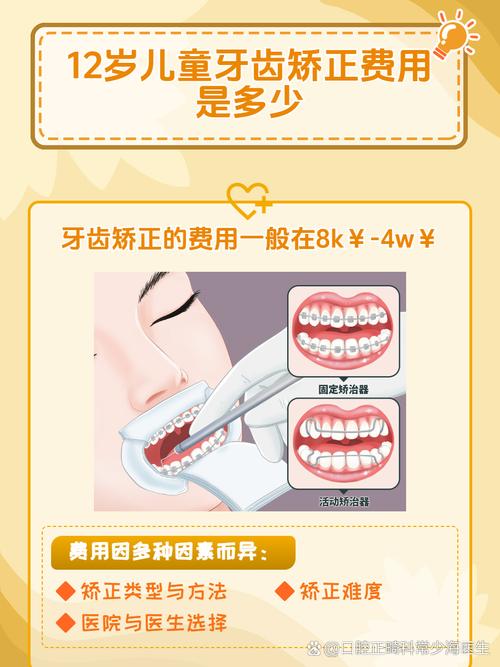 长沙12岁矫正牙齿要多少钱？医生揭秘各阶段费用明细
