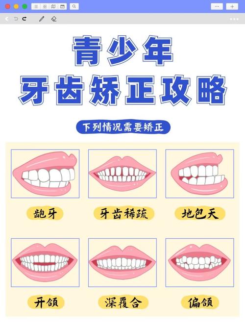 长沙15岁牙齿不齐别慌！抓住矫正黄金期，这些方法快收藏