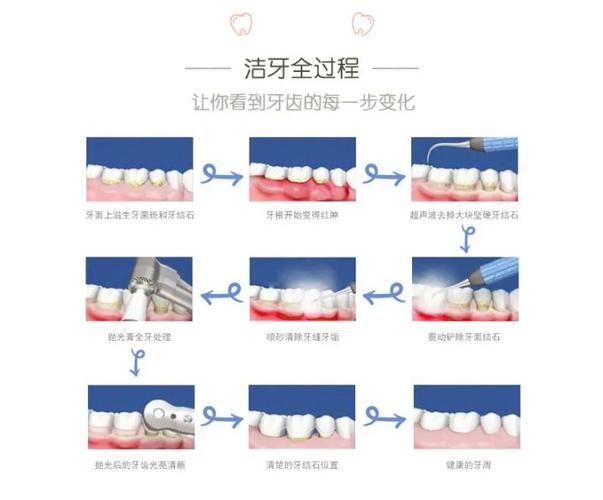 长沙深圳宝安隐适美正品认证医院怎么选？