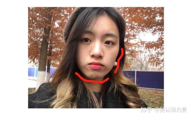 长沙莲塘小孩正畸多少钱？费用明细和避坑指南