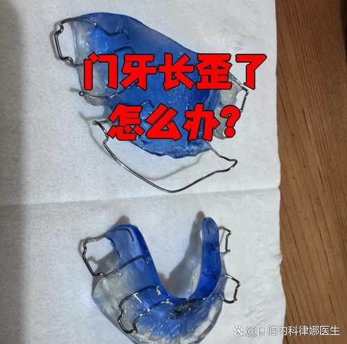 长沙牙齿长歪了怎么矫正？多少钱能搞定？