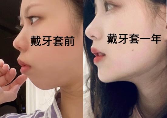 长沙郴州做牙齿矫正哪家好？看完这篇不踩坑