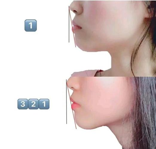 长沙34岁做龅牙矫正还来得及吗？我的真实感受