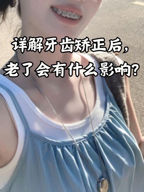 长沙40岁还能矫正牙齿吗？看完这篇文章让你了解40岁牙齿矫正的真相