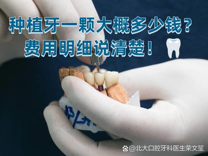 深圳坪山单颗种植牙报价_深圳种植牙价位_深圳种植牙多少钱一颗2020