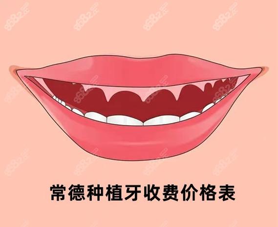 长沙常德半口种植牙费用2026大概多少钱？真实价格参考